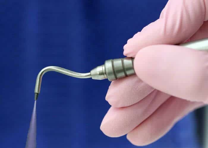 La microabrasió dental permet tractar càries de manera mínimament invasiva, sense mo-lèsties, vibracions ni sons aguts